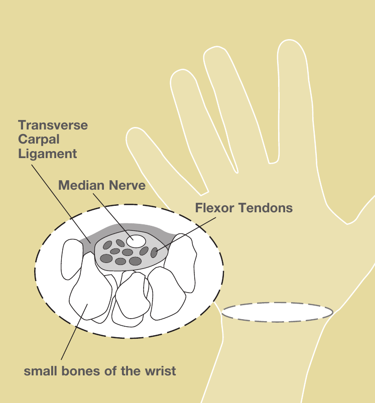 Cross-section of the wrist showing the carpal tunnel, median nerve, flexor tendons, transverse carpal ligament, and small bones of the wrist