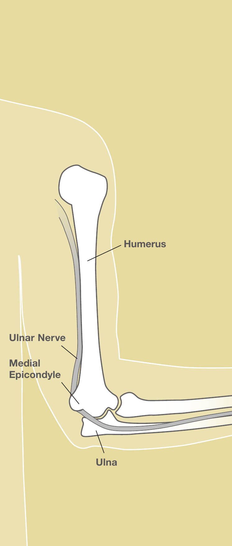 Anatomy of the elbow showing the humerus, medial epicondyle, ulna, and the ulnar nerve running behind the medial epicondyle