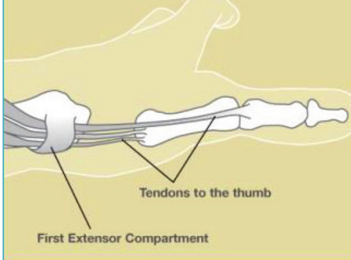 Illustration of the thumb tendons passing through the first dorsal compartment at the wrist