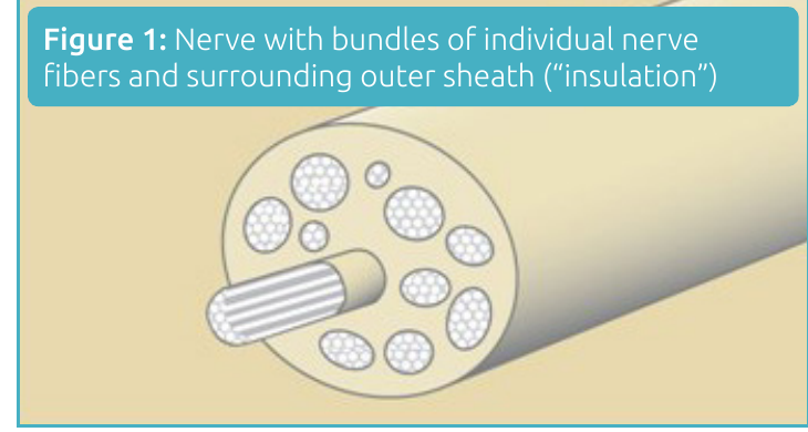 Cross-section illustration of a peripheral nerve showing bundles of nerve fibers inside a protective outer sheath