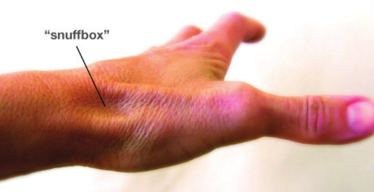 Hand with arrow pointing to the anatomic snuffbox, a small dip at the base of the thumb