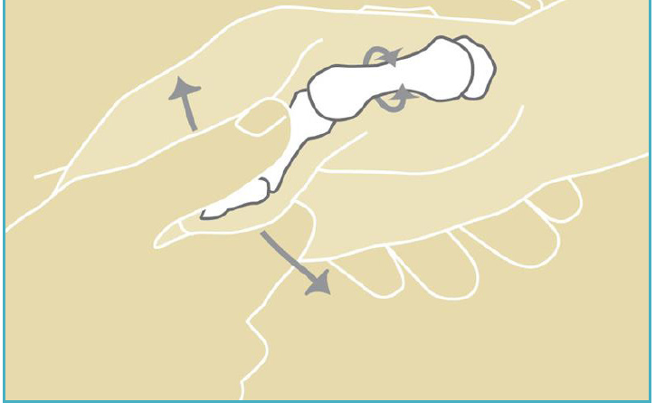 Illustration of the grind test, in which the examiner rotates the thumb metacarpal against the trapezium to reproduce joint pain