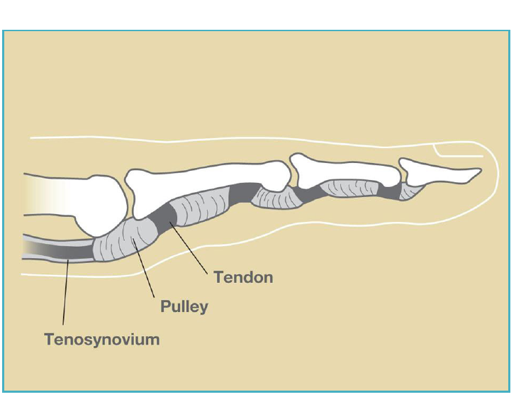 Side view of a finger showing the flexor tendon, pulley, and tenosynovium